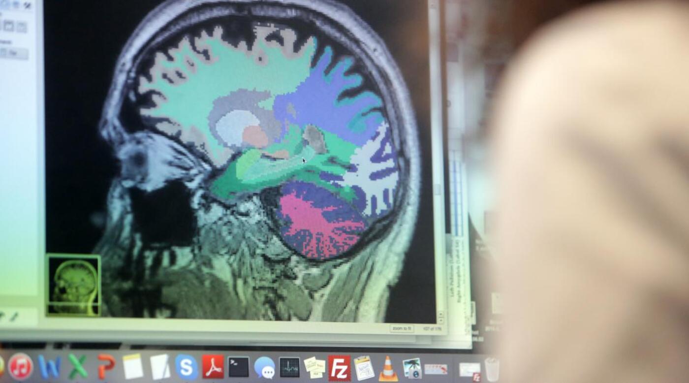 F8 brainreader hjerne