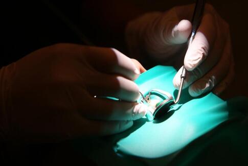 En tand bedre med nyt mikroskop